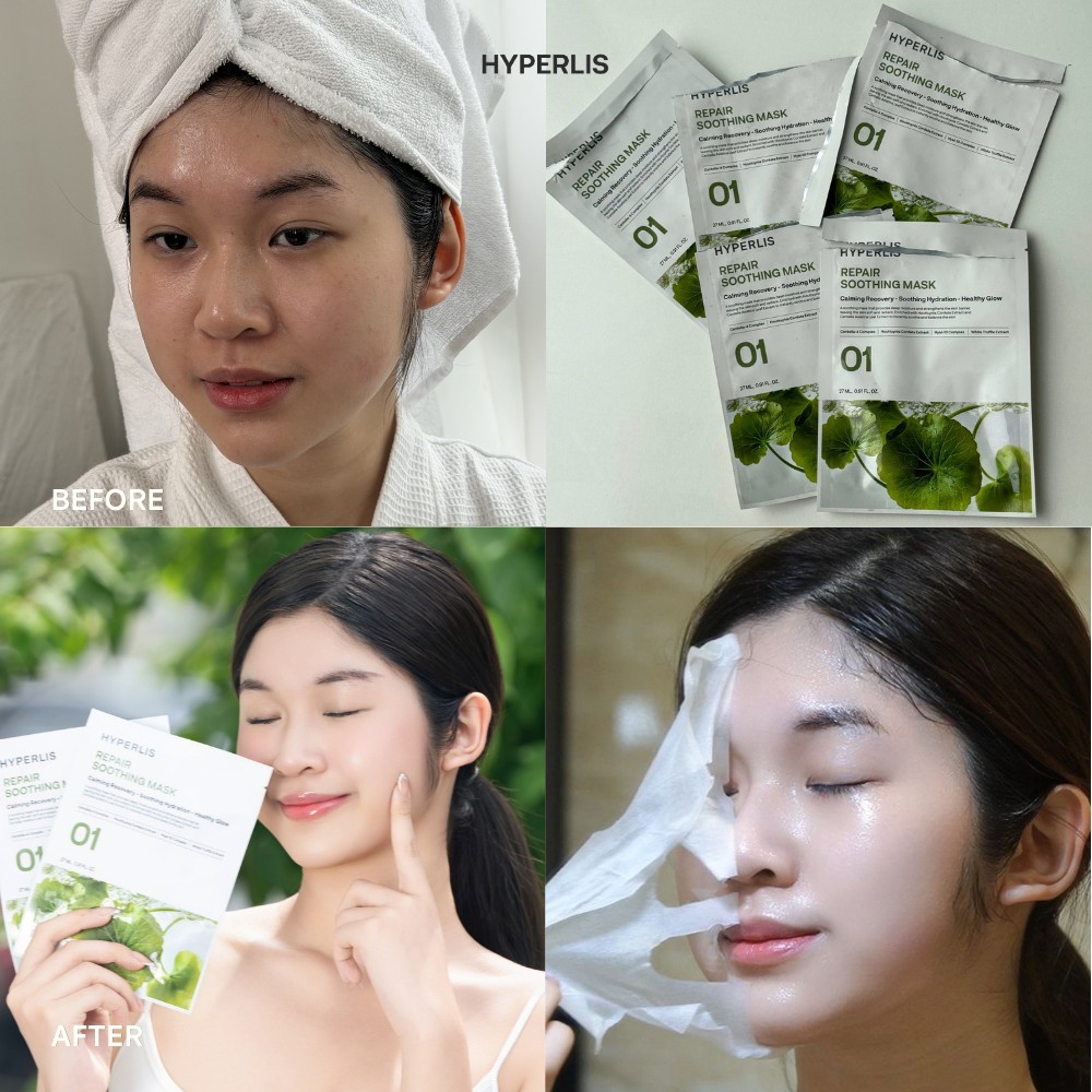 Trước sau dùng mặt nạ HYPERLIS 3